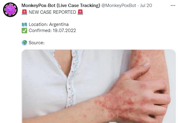 ¿Dónde surgieron los primeros casos de la viruela del mono?