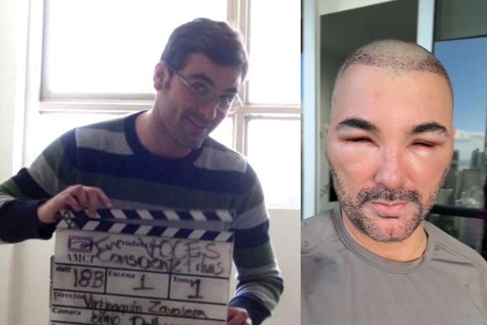 Causa horror el rostro del actor mexicano Mauricio Mejía tras cirugía estética featured image