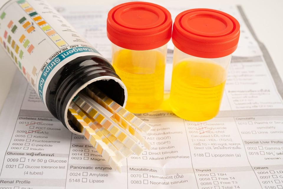 ¿Qué revela el color de tu orina sobre tu salud? Aprende a interpretarlo