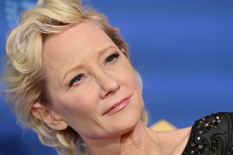 Reportan que la actriz Anne Heche está en coma después de accidente de auto