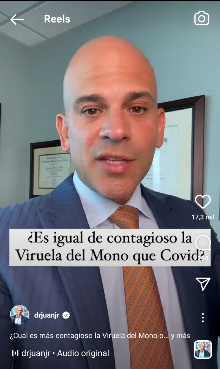 Viruela del mono Covid