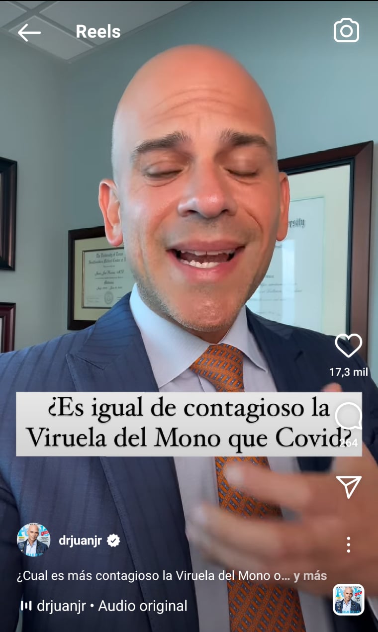 Viruela del mono Covid