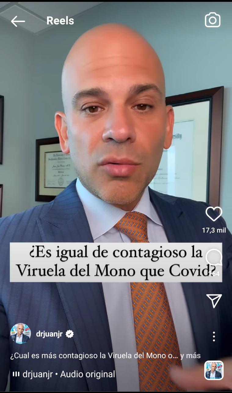 Viruela del mono Covid