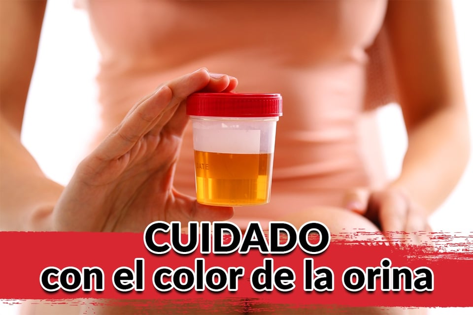 ORINA amarilla o café: ¿Cuándo debes preocuparte por el COLOR?