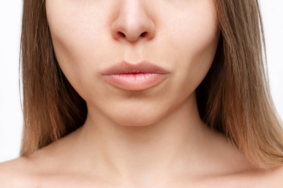 eliminación de grasa bucal, mujer, cara, belleza, piel, cirugía estética