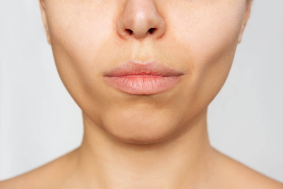 cosmetología, cirugía plástica, eliminación de grasa bucal, MundoNOW, pomulos