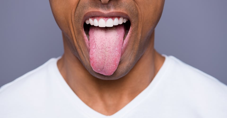 Problemas en la lengua: síntomas y tratamientos