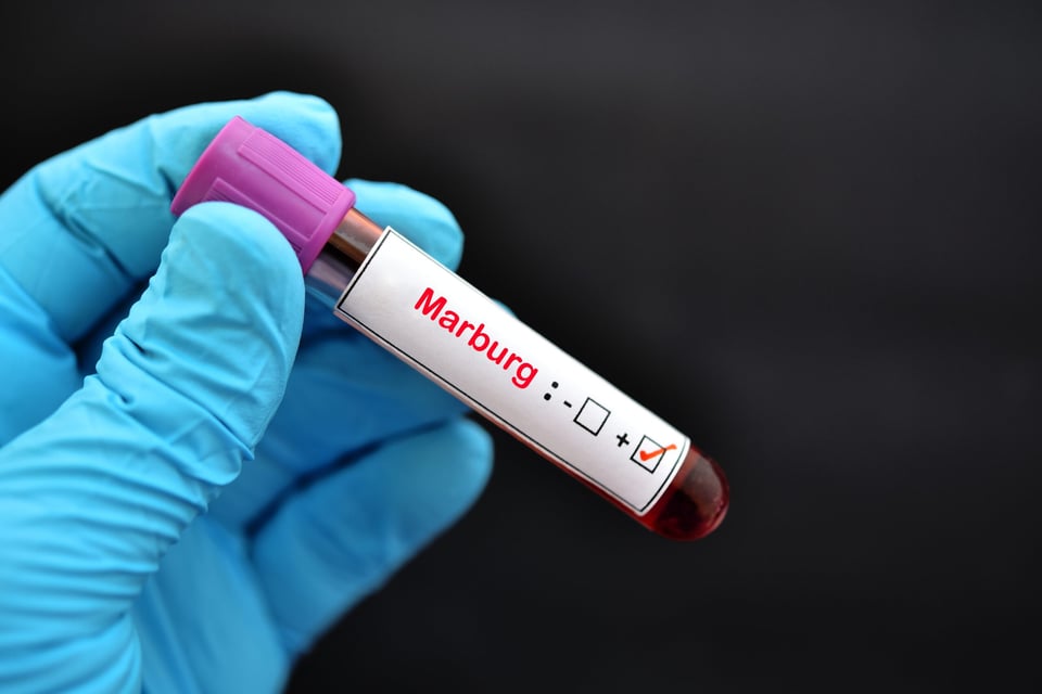 Los CDC emiten alerta por virus Marburgo en EEUU después de brotes en África 
