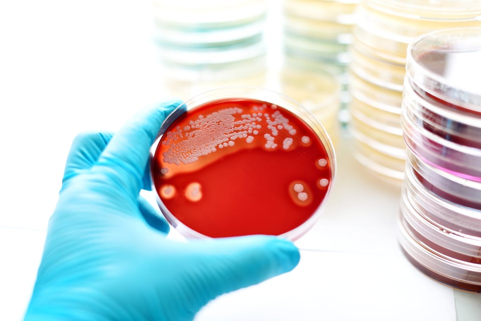 Muestra de sangre Muestra de sangre