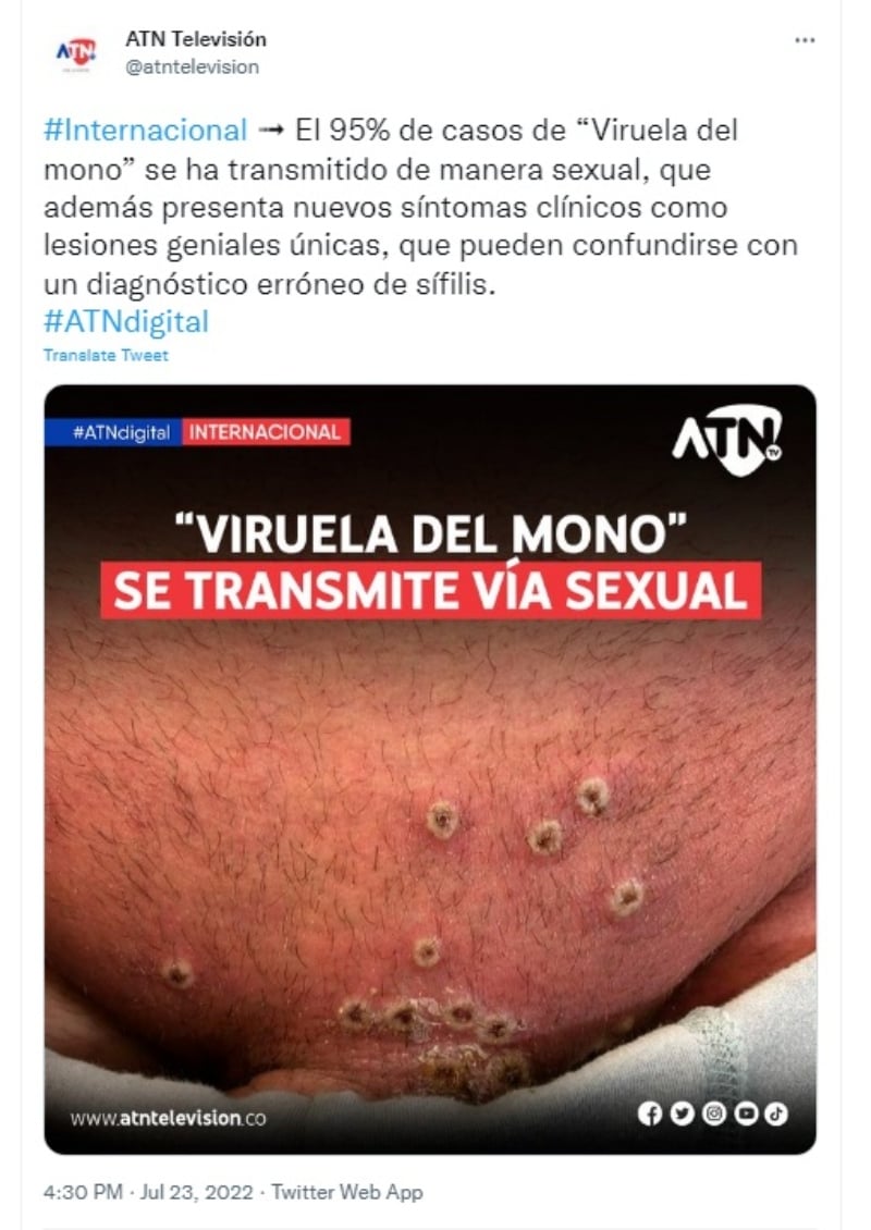 ¿Cómo se pueden contagiar?
