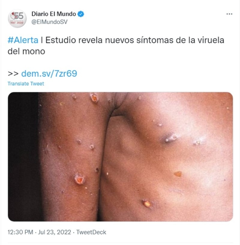 "La infección se puede propagar"